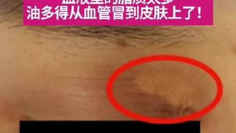 判定犯规埃朱马远，体育赛事，射破门瞬间，进球被判无效解析